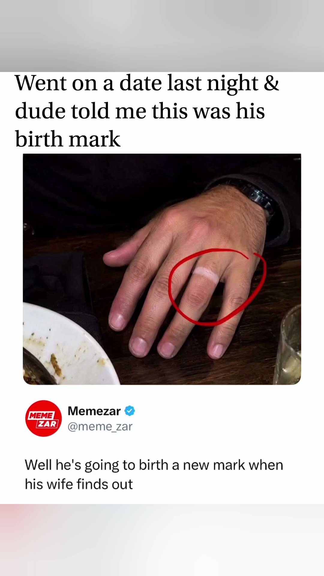 He Lied About His Birthmark#viralshorts#birthmarks #funnyshorts #usa#trendingshorts #viral