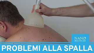 Problemi Alla Spalla.