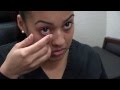 How to Apply Ointment to the Eyes and Eyelids