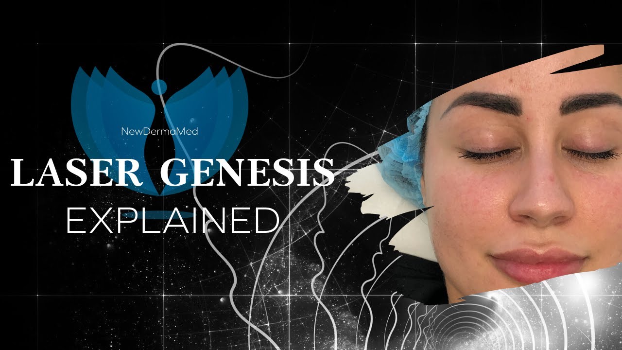 LASER GENESIS SKIN REJUVENATION -  boost collagen production for healthy skin | FACIAL TREATMENT