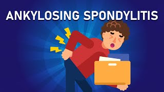 What is Ankylosing Spondylitis? | Arthritis That Fuses Your Bones