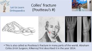 Let us learn Orthopaedics- Colles Fracture
