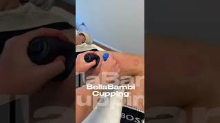 Leistung Jetzt Mit Code Physiobasel Sparen Und Dein Training Auf Das Nächste Level Bringen.