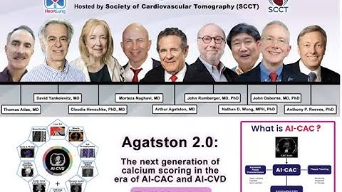 (Full Version) Agatston 2.0: The next generation of calcium scoring in the era of AI-CAC and AI-CVD