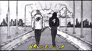 Lil Durk \& Lil Baby - Bruised Up (Official Video Audio) [V.O.T.H Album]