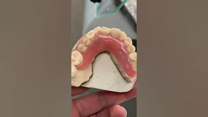 Partial with a Wire Clasp @EnvisiontecMain #envisiontec #dental #teeth #smile #lsk121shorts