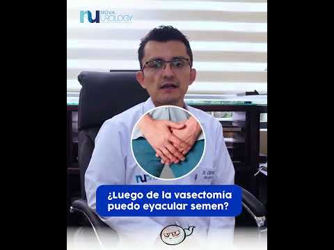 ¿Luego de la vasectomía puedo eyacular semen?