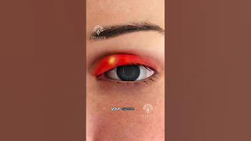 What S REALLY Causing Your Eye Stye Shorts Viralvideo Creativelearning3d 