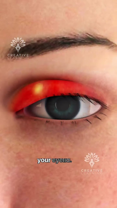 What's REALLY Causing Your Eye Stye? 😮 #shorts #viralvideo - Creativelearning3d