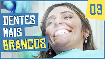 Quantas vezes pode fazer clareamento nos dentes?