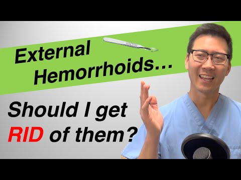 Video: 3 moduri de a sta cu hemoroizi