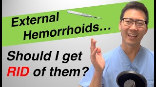 External hemorrhoid treatment: Should I REMOVE or LEAVE them? screenshot 4