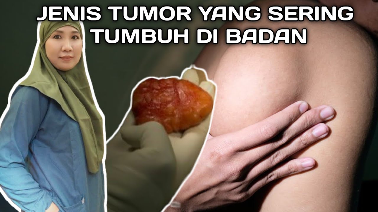 Benjolan yg sering di TUMBUH di tubuh 