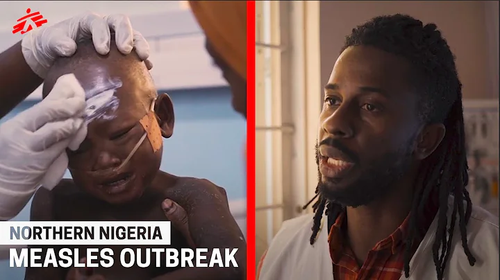 Measles outbreak could have deadly consequences in Nigeria