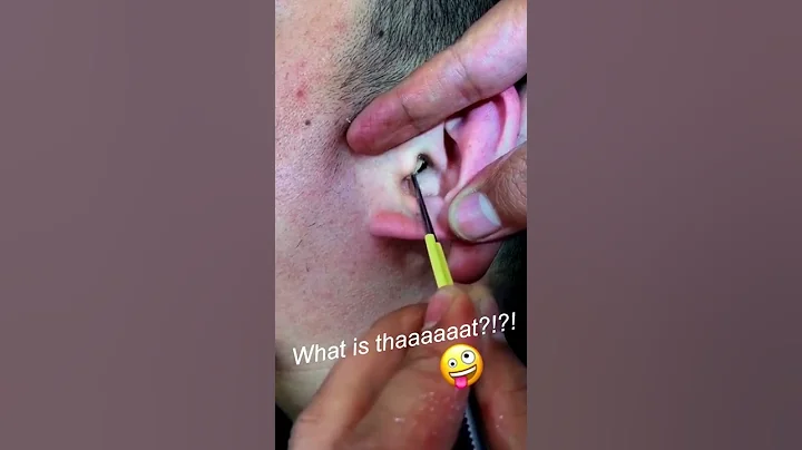 WHAAT IS THAAAT ?