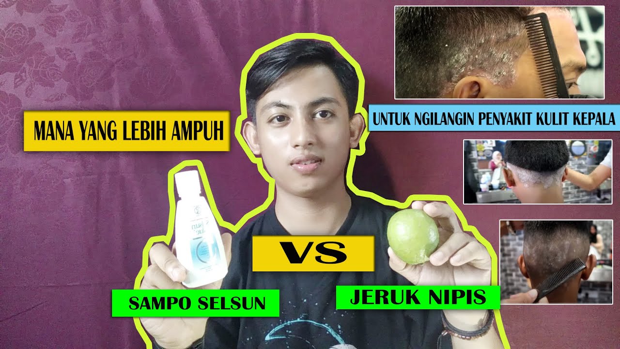 MANA YANG LEBIH AMPUH UNTUK MENGOBATI PSORIASIS, DERMATITIS SEBOROIK