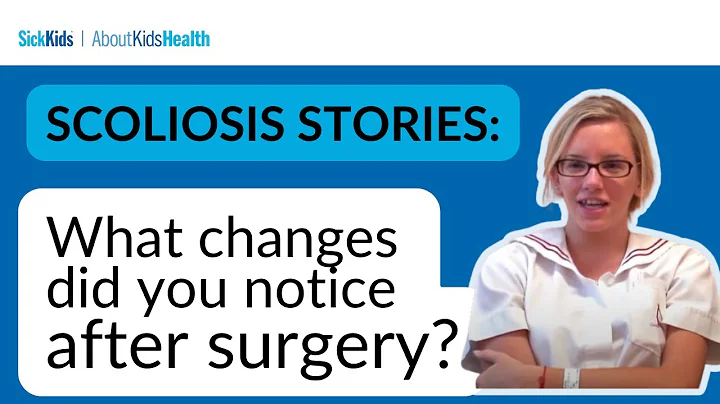 Scoliosis stories: What changes did you notice in your body after the surgery? | SickKids