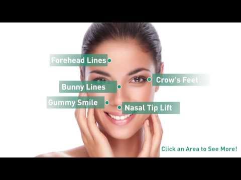 Botox Cosmetic | Uses for Botox | San Diego Dermatology Botox Cosmetic | Uses for Botox | San Diego Dermatology