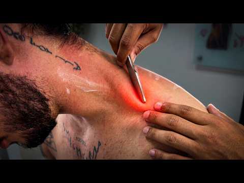 NECK AND SHOULDER PAIN | CHIROPRACTIC AND MYOFASCIAL RELEASE. VILA LEOPOLDINA