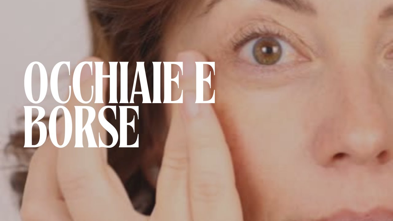 Perché hai sempre le occhiaie (anche se dormi)?