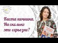 Киста яичника опасно ли это? Причины возникновения кисты яичника?