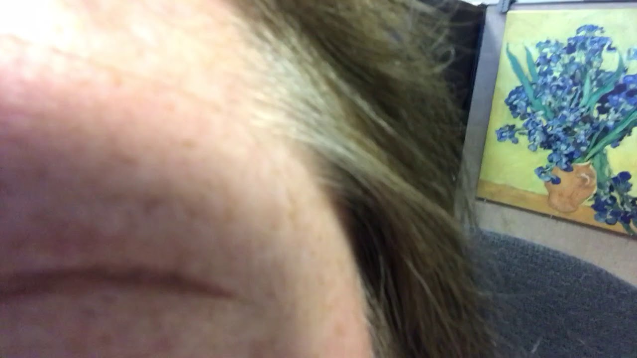 3 28 18 public works alhambra california forehead swollen alhambra public works