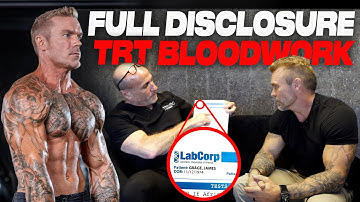 My TRT / Testosterone Protocol Reviewed by Doctor: Free Testosterone, SHBG, DHT, Estradiol & More…
