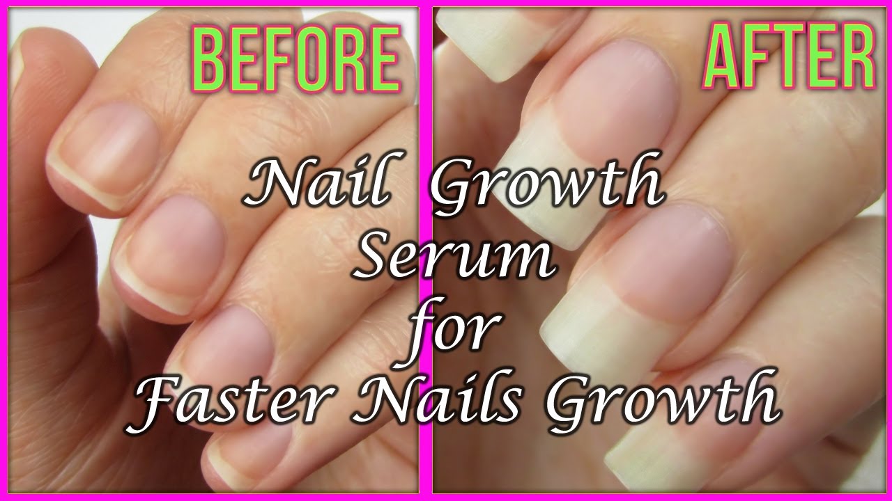 Homemade Nails growth serum | How to Grow Nails Faster - 100 % ...
