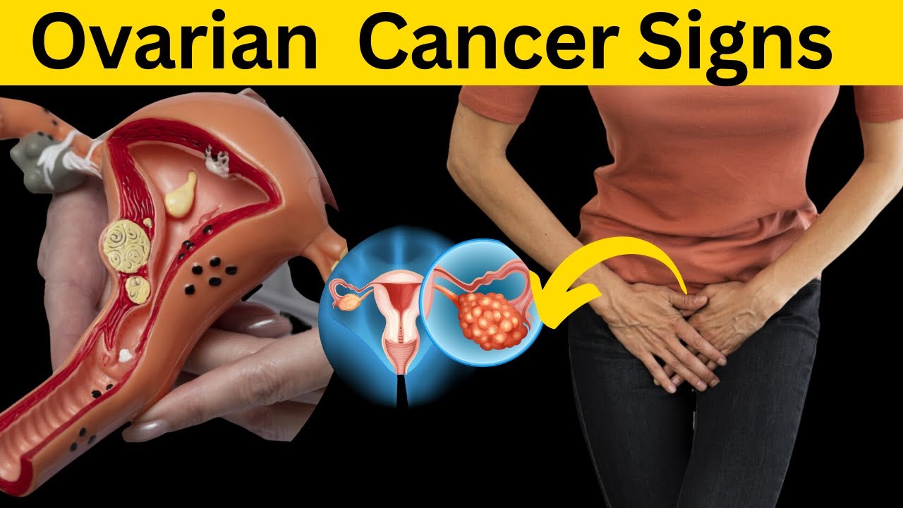 Women's Health Alert, 10 Must Know Ovarian Cancer Symptoms