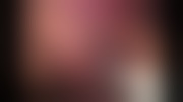 Lap Liver Metastasis Resection