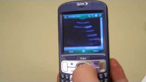 Cell Phone Ultrasound Tutorial Part 1
