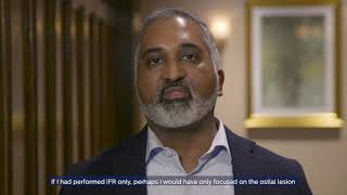 Improving your treatment strategy with iFR Co-registration
