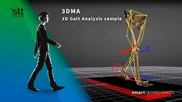 3D Gait Analysis sample | 3DMA
