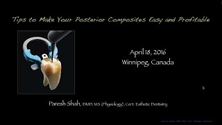 Dental Education: Posterior Dental Composites Easy and Simple by Dr. Paresh Shah