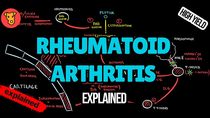 Immunopathogenesis of rheumatoid arthritis pdf review