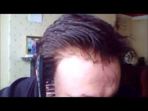 Men S Wigs Tous Hair Systems Amazing Hairline Non Surgical Men S Wigs Tous Hair Systems Amazing Hairline Non Surgical Full Cap