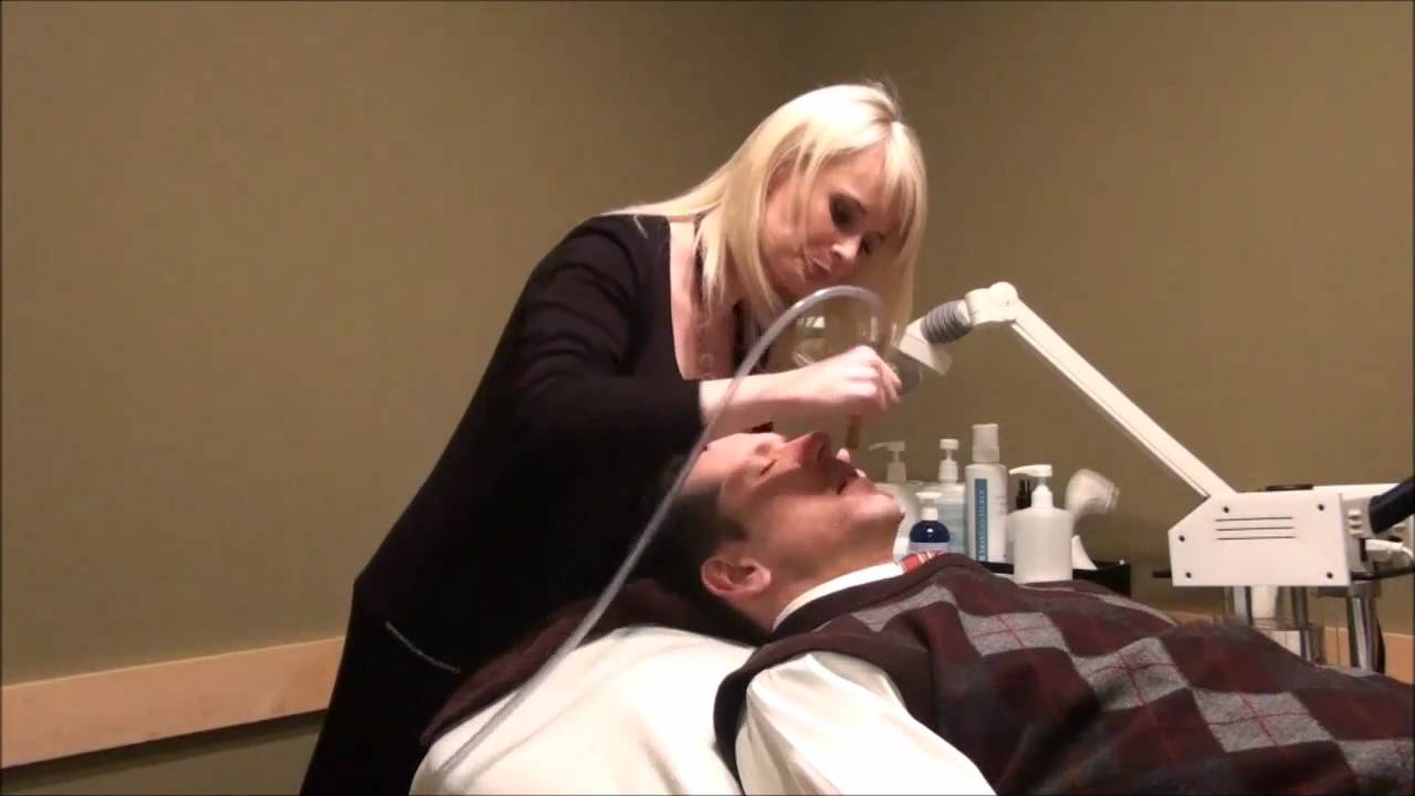 Microdermabrasion Demonstration YouTube