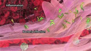 Skin Wound Inflammation Narrated 2014 By Drew Berry Wehitv