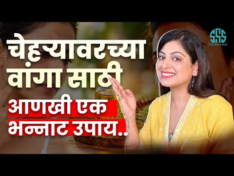 वांग , काळेडाग यासाठी कमाल घरगुती रेमेडी आणि प्रोडक्ट