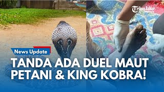 Download Lagu Misteri Titik Hitam di Jempol Kaki Petani! Dinilai Bukti seusai Duel dengan King Kobra di Sukabumi MP3 Download Lagu Misteri Titik Hitam di Jempol Kaki Petani! Dinilai Bukti seusai Duel dengan King Kobra di Sukabumi MP3