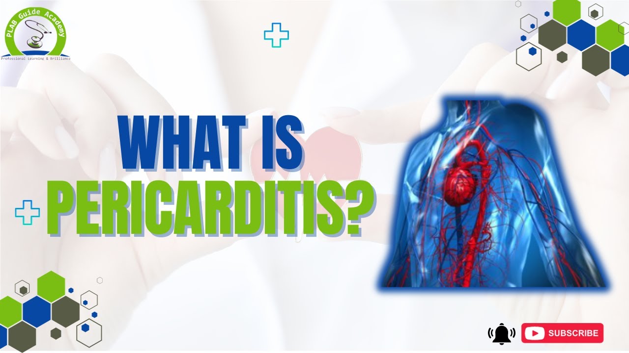 Pericarditis | PLAB GUIDE ACADEMY