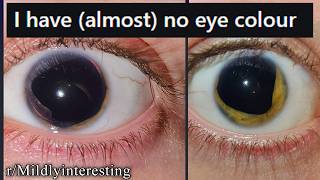 r/Mildlyinteresting | woah