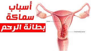 ماهي اسباب واعراض سماكة وتضخم بطانة الرحم وطرق علاجها؟