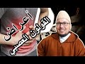 أعراض القولون العصبي