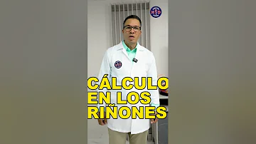 ¿Cómo hacer que un cálculo salga rápido?