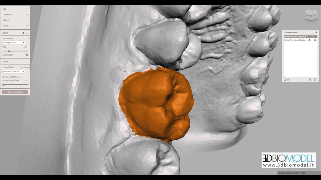 Provvisorio prelimatura in 5 minuti con Meshmixer, software 3D gratuito