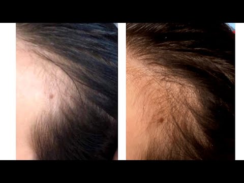 Videó: A hajhab káros?