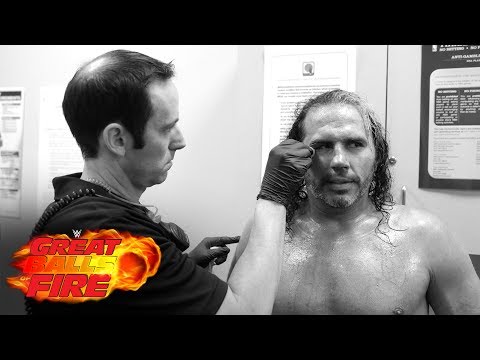 Matt Hardy receives 9 stitches following a 30-Minute WWE Iron Man Match: Exclusive, July 9, 2017