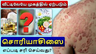 வீட்டிலேயே முகச் சொரியாசஸை குணப்படுத்துவது எப்படி? | How to cure face psoriasis at home?