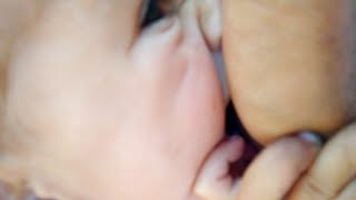 She Bit Me Hard | Baby Biting | Cute Baby Videos | Awesomely Cute Babies